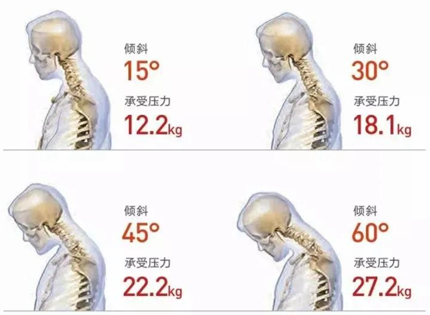 激光切割機助力金屬電腦支架,解決辦公族“低頭病”(圖2) 激光切割機助力金屬電腦支架,解決辦公族“低頭病”